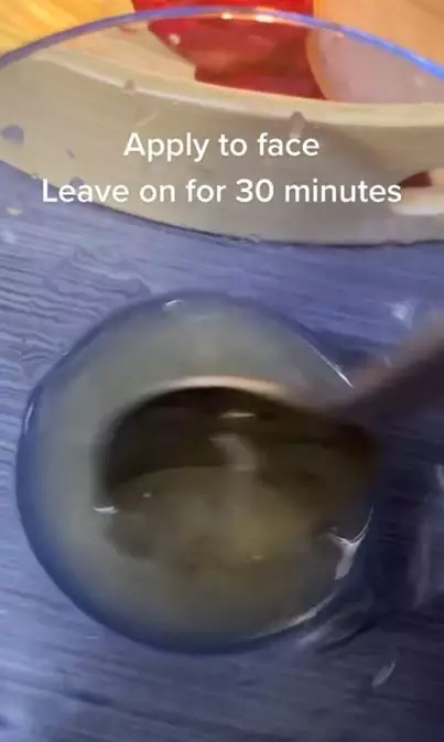 Atasi flek hitam bekas jerawat dengan tambahan 1 bahan dapur Berbagai sumber