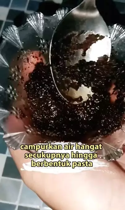 Pudarkan stretch mark setelah diet dengan 1 bahan minuman Berbagai sumber Pudarkan stretch mark setelah diet dengan 1 bahan minuman Berbagai sumber