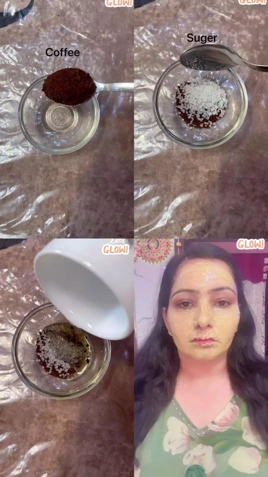 kasar akibat komedo © Instagram