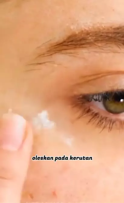 Atasi keriput area mata pakai 1 bahan makanan Berbagai sumber Atasi keriput area mata pakai 1 bahan makanan Berbagai sumber