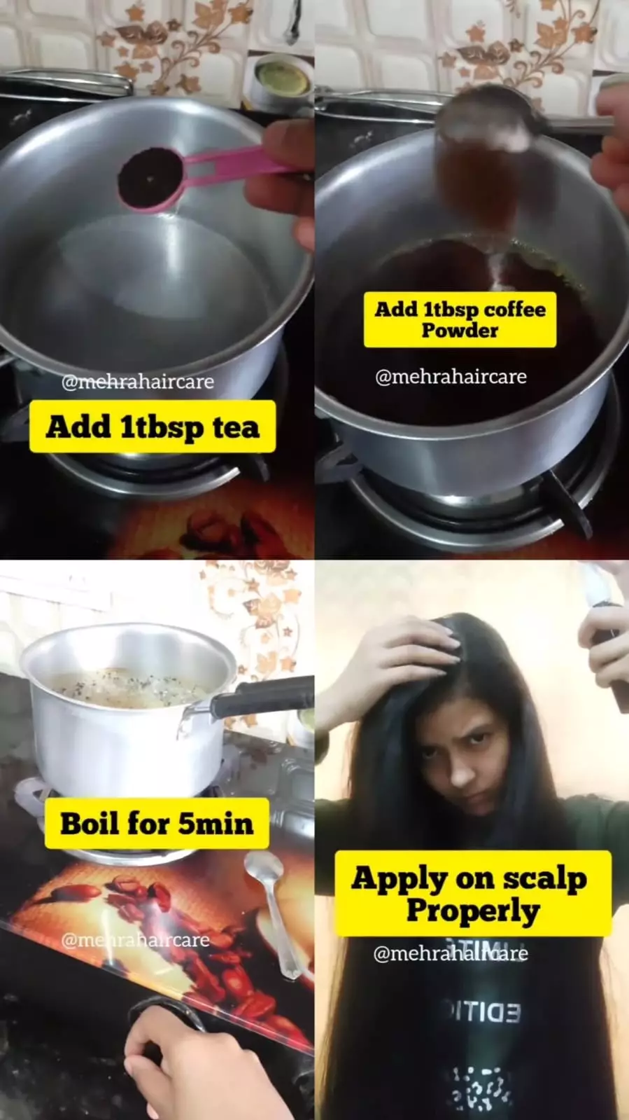 uban berlebih di usia muda © Instagram