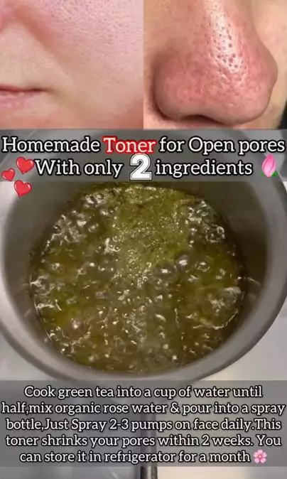 Mengecilkan pori besar dan tersumbat pakai 1 bahan minuman Berbagai sumber