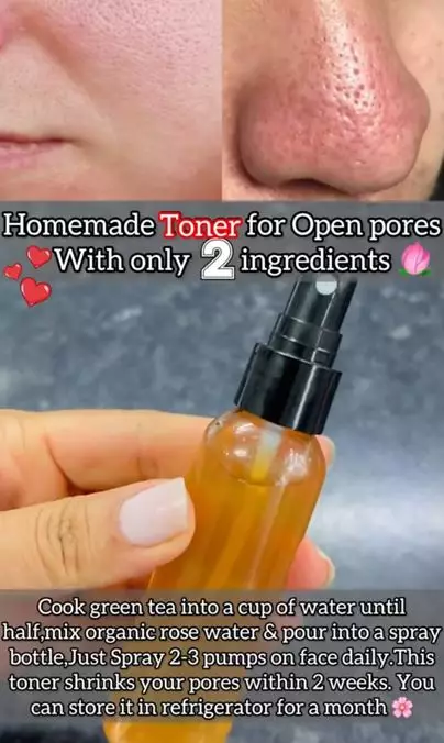 Mengecilkan pori besar dan tersumbat pakai 1 bahan minuman Berbagai sumber