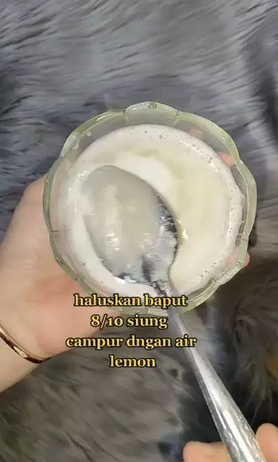 Hilangkan kutu penyebab kepala gatal dengan tambahan 1 bumbu dapur Berbagai sumber Hilangkan kutu penyebab kepala gatal dengan tambahan 1 bumbu dapur Berbagai sumber