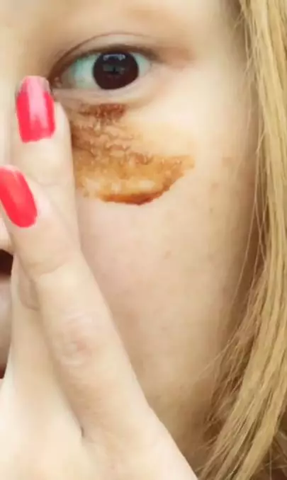 Cerahkan kantung mata hitam dengan tambahan 1 jenis umbi-umbian Berbagai sumber