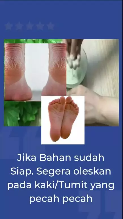 haluskan tumit kaki berbagai sumber haluskan tumit kaki berbagai sumber