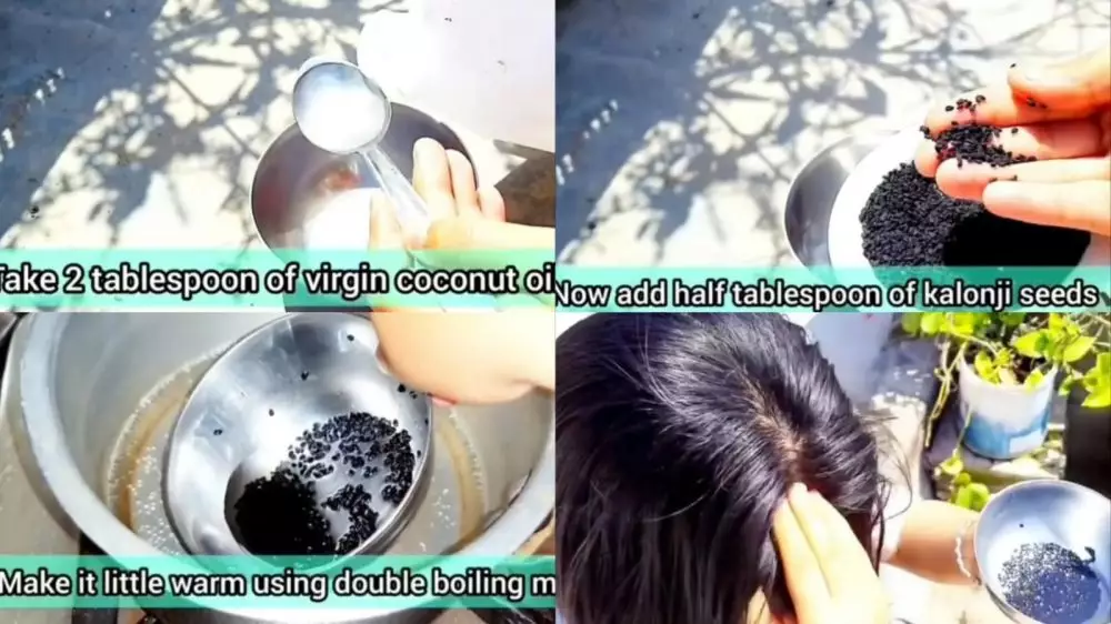 uban di usia © Instagram uban di usia © Instagram