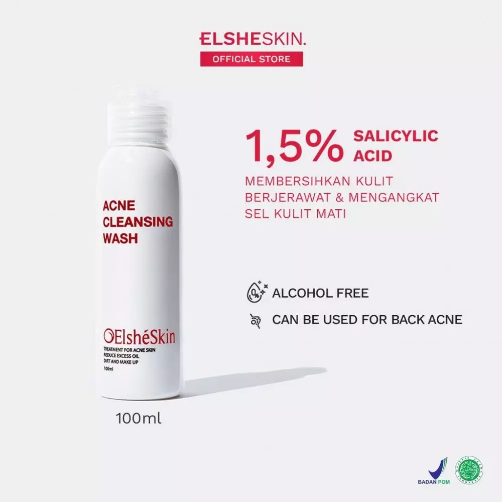 kulit berminyak dan berjerawat © berbagai sumber