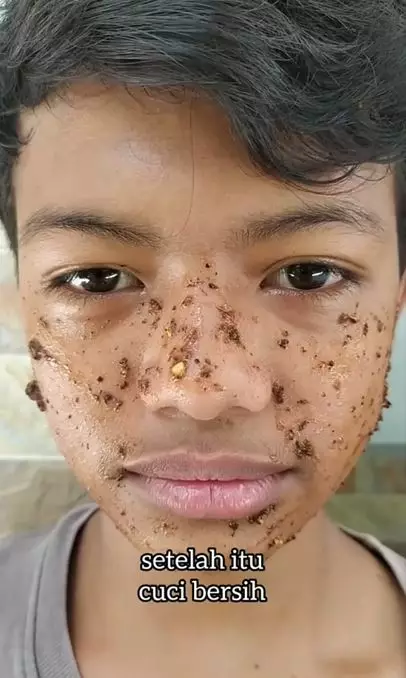 Wajah belang jadi putih dan kinclong pakai 1 bahan minuman Berbagai sumber