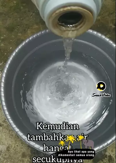 atasi kaki retak pakai madu berbagai sumber