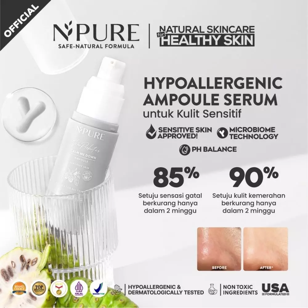 serum untuk kulit sensitif © berbagai sumber