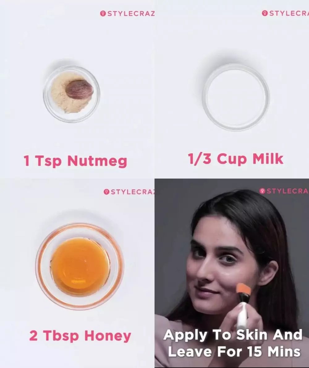 hilangkan jerawat meradang © Instagram