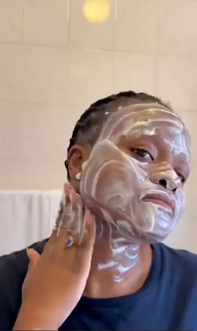 Pudarkan flek hitam dan jerawat pakai 1 jenis olahan susu Berbagai sumber