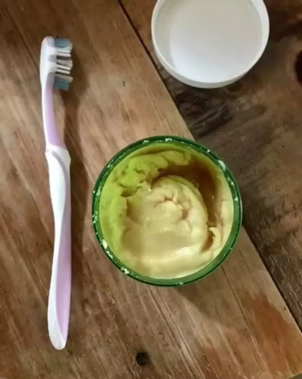 gigi kuning akibat minum kopi berbagai sumber gigi kuning akibat minum kopi berbagai sumber