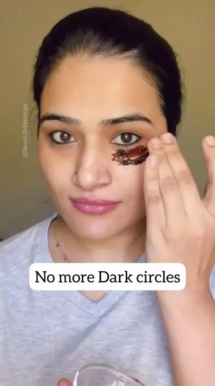 atasi dark circle berbagai sumber