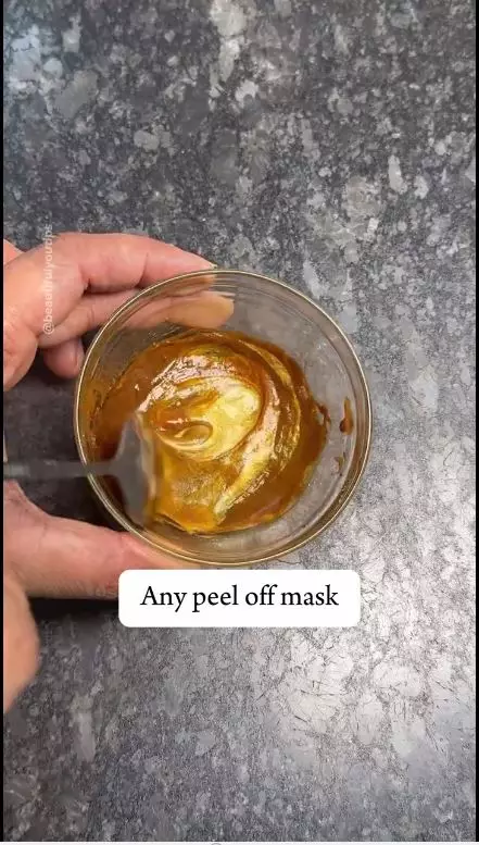 cara hilangkan komedo berbagai sumber