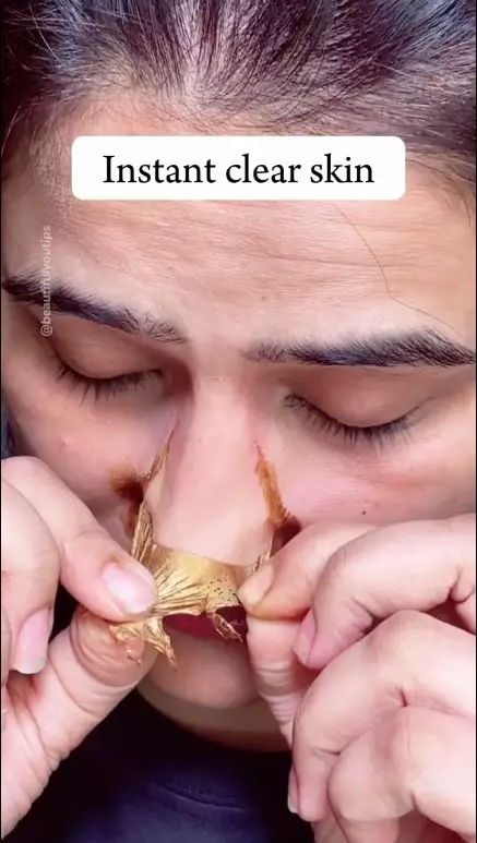 cara hilangkan komedo berbagai sumber