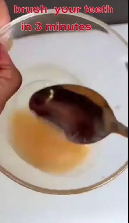  trik pudarkan noda kuning pada gigi berbagai sumber