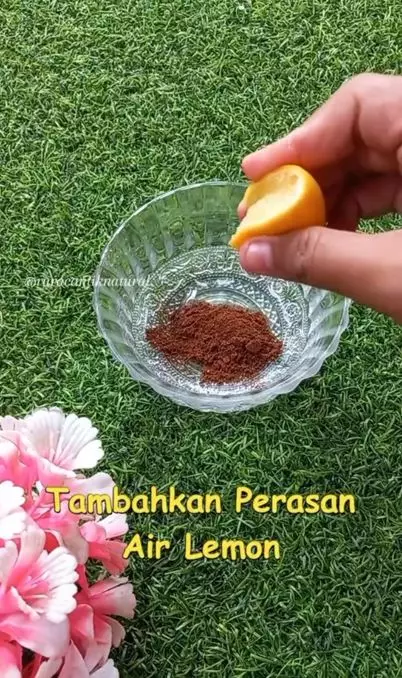 Pudarkan stretch mark usai melahirkan Berbagai sumber