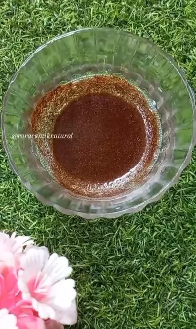 Pudarkan stretch mark usai melahirkan Berbagai sumber