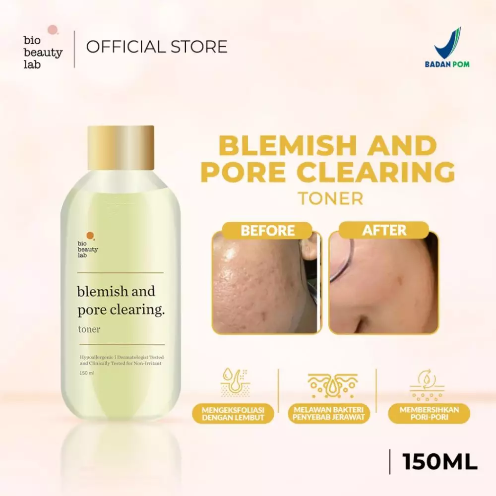 skincare untuk mengecilkan pori-pori © berbagai sumber