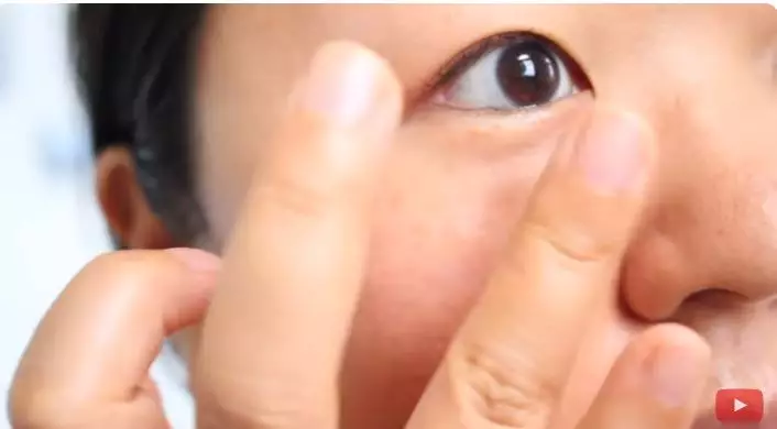 atasi kantung mata berbagai sumber