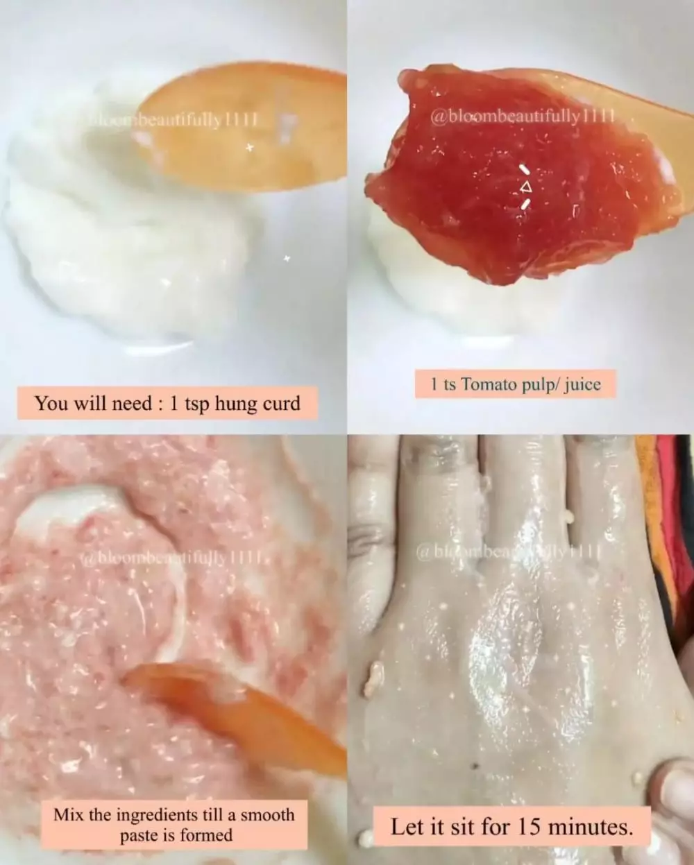 wajah kasar akibat jerawat © Instagram