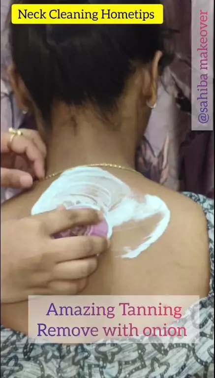 cara rontokan daki di leher berbagai sumber cara rontokan daki di leher berbagai sumber