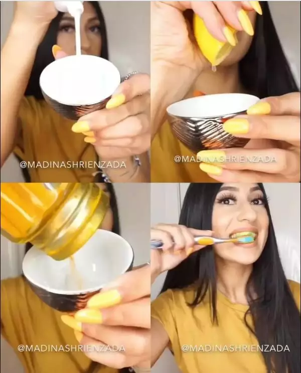 Cara bikin gigi putih cemerlang berbagai sumber