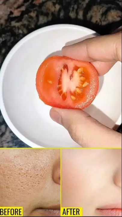 cara bersihkan pori-pori tersumbat berbagai sumber