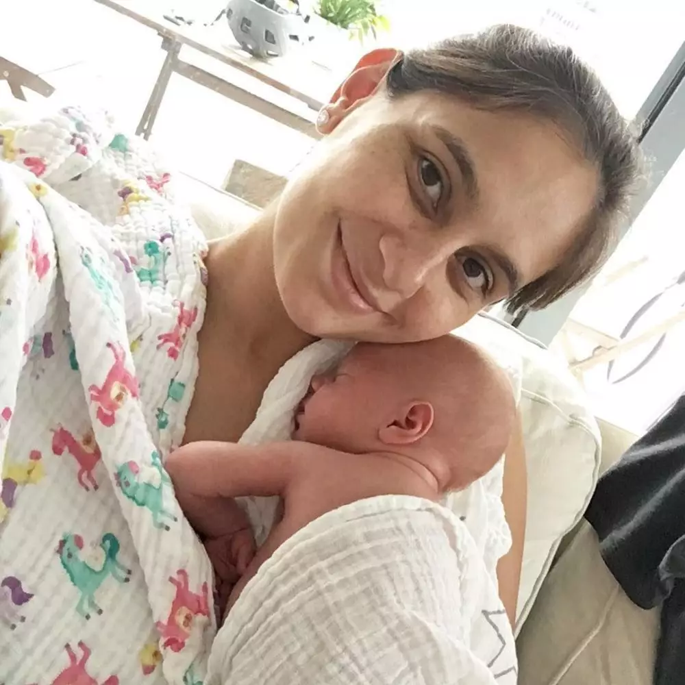 pesona seleb pamer freckles © instagram