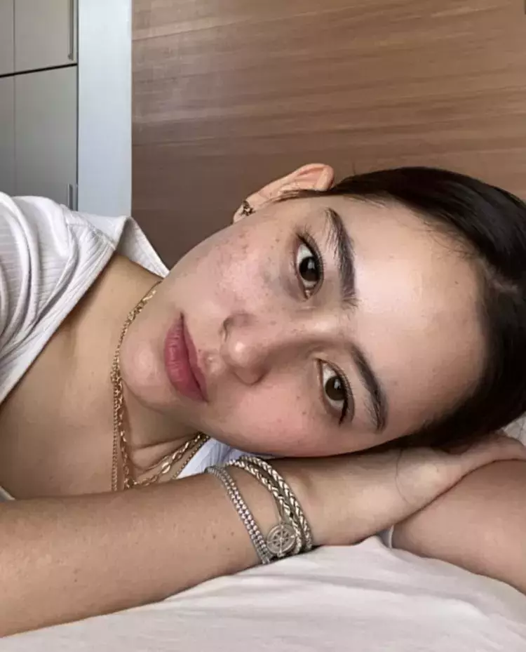 pesona seleb pamer freckles © instagram