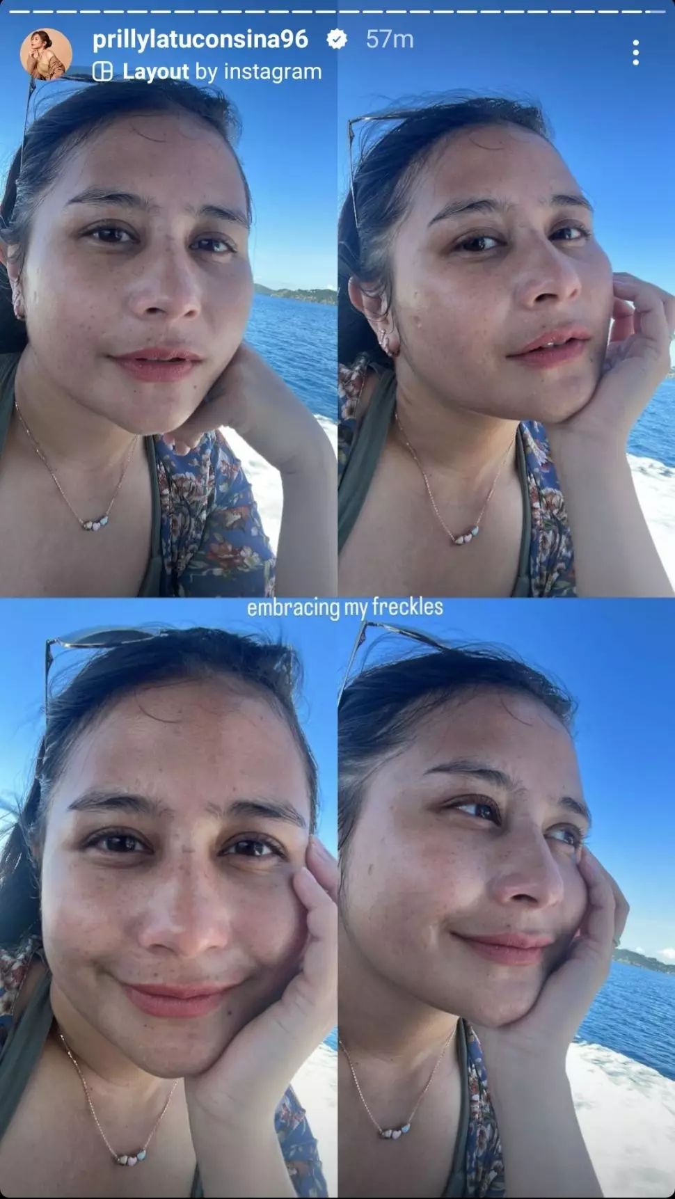 pesona seleb pamer freckles © instagram