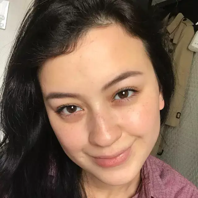 pesona seleb pamer freckles © instagram