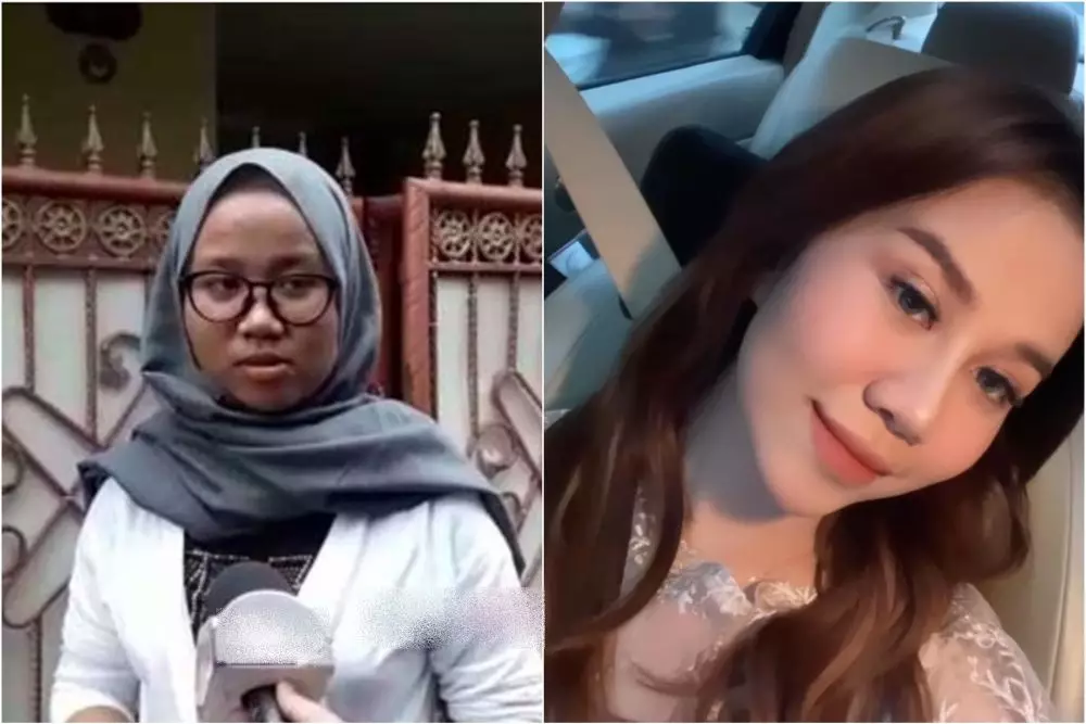 mayang sebelum dan sesudah operasi © berbagai sumber
