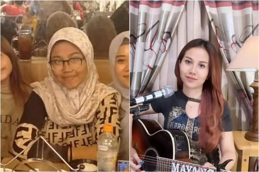 mayang sebelum dan sesudah operasi © berbagai sumber