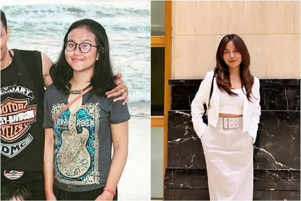 mayang sebelum dan sesudah operasi © berbagai sumber