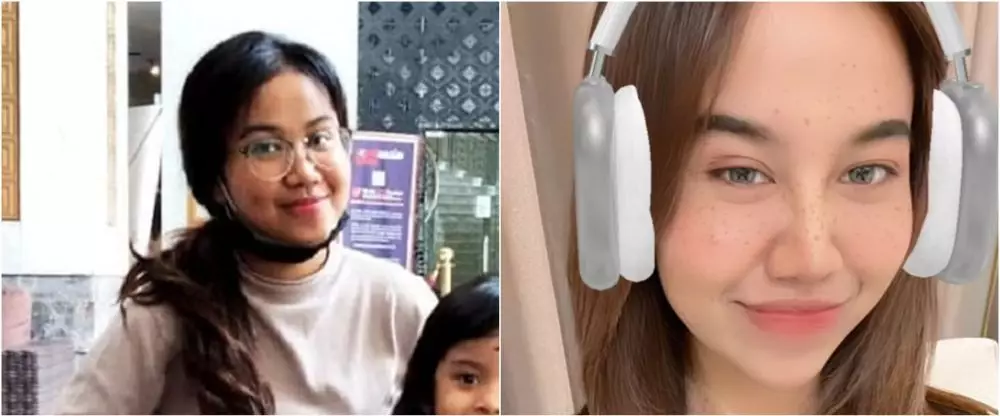 mayang sebelum dan sesudah operasi © berbagai sumber