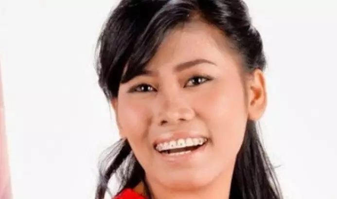 Evi Masamba usai perawatan tanam benang © berbagai sumber