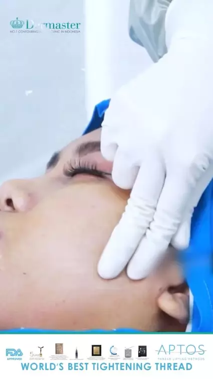 Evi Masamba usai perawatan tanam benang © berbagai sumber