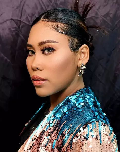 Evi Masamba usai perawatan tanam benang © berbagai sumber