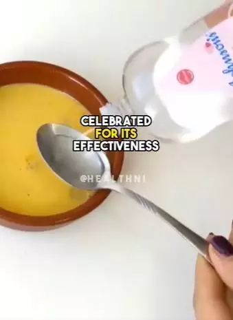 Cegah tumbuhnya uban prematur Berbagai sumber Cegah tumbuhnya uban prematur Berbagai sumber