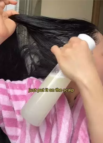 Atasi rambut rontok dan tipis Berbagai sumber