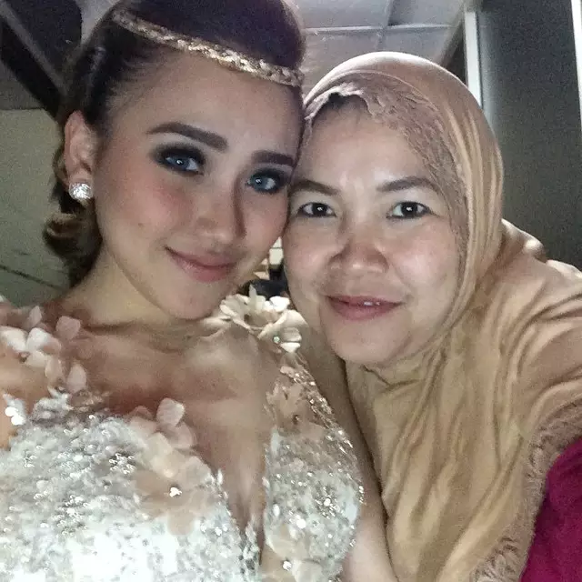 transformasi wajah umi kalsum © instagram transformasi wajah umi kalsum © instagram