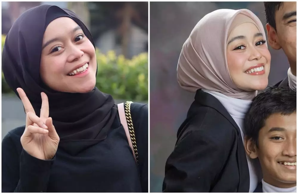 seleb gigi gingsul dan tanpa gingsul © berbagai sumber