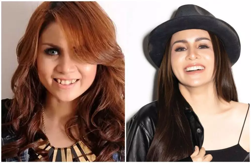 seleb gigi gingsul dan tanpa gingsul © berbagai sumber