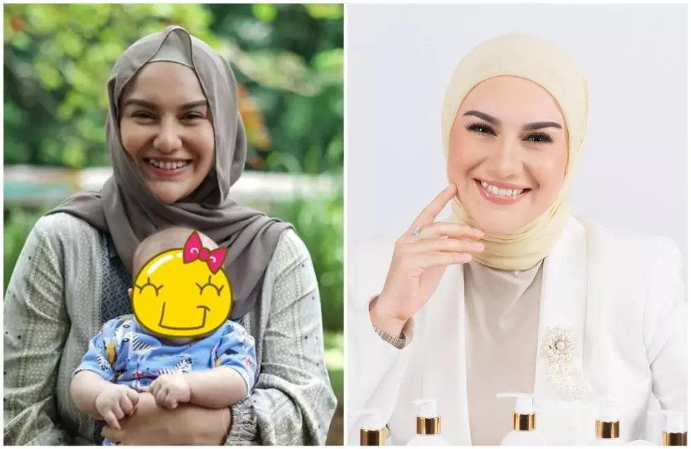 seleb gigi gingsul dan tanpa gingsul © berbagai sumber