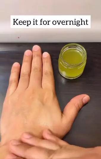 Atasi flek hitam dan wajah kendur Berbagai sumber Atasi flek hitam dan wajah kendur Berbagai sumber