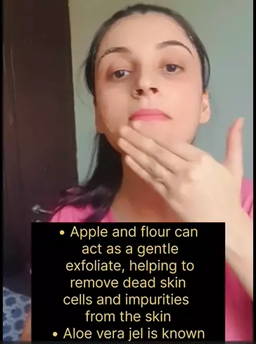 atasi jerawat membandel berbagai sumber atasi jerawat membandel berbagai sumber