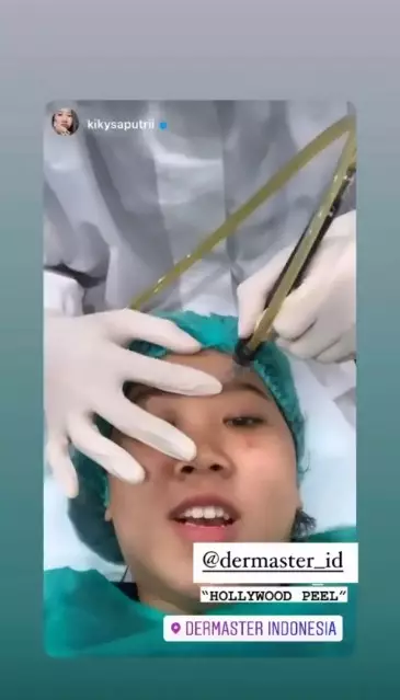 Kiky Saputri sebelum dan usai perawatan © berbagai sumber Kiky Saputri sebelum dan usai perawatan © berbagai sumber